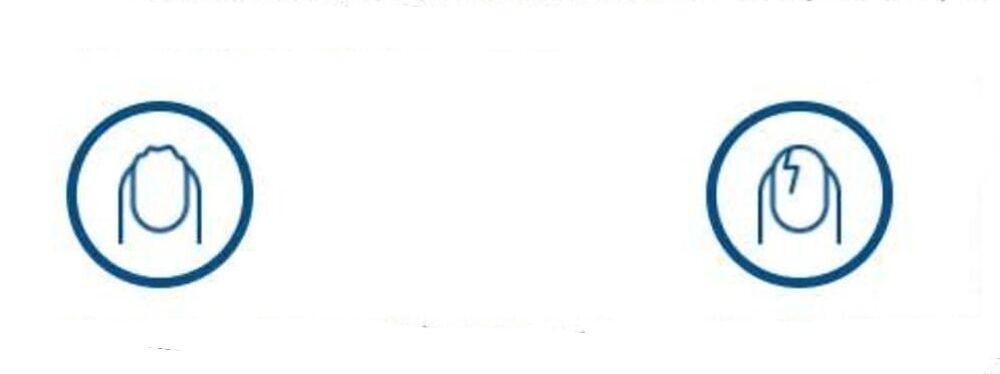 παραμόρφωση των νυχιών λόγω μυκητιασικής λοίμωξης